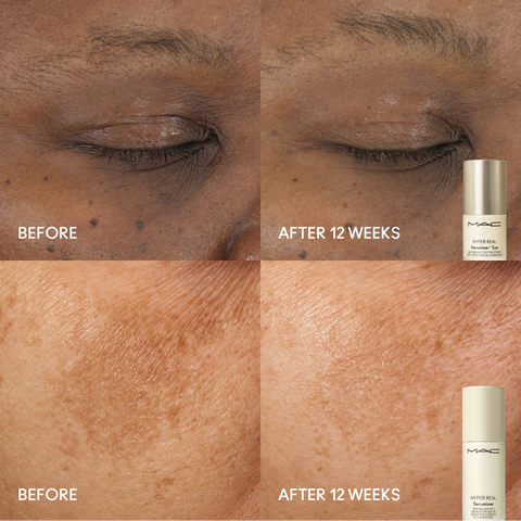 Hyper Real™ Radiant Face + Eye Kit